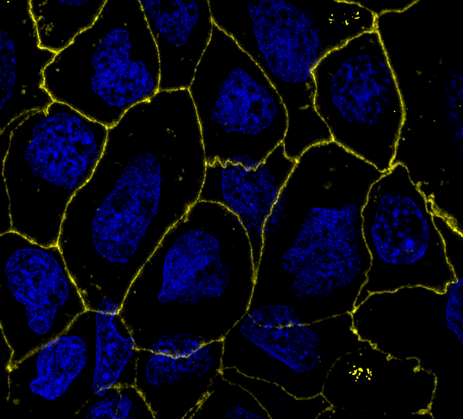 Fluorescence micrograph showing epithelial cells with blue nuclei and yellow cell borders.