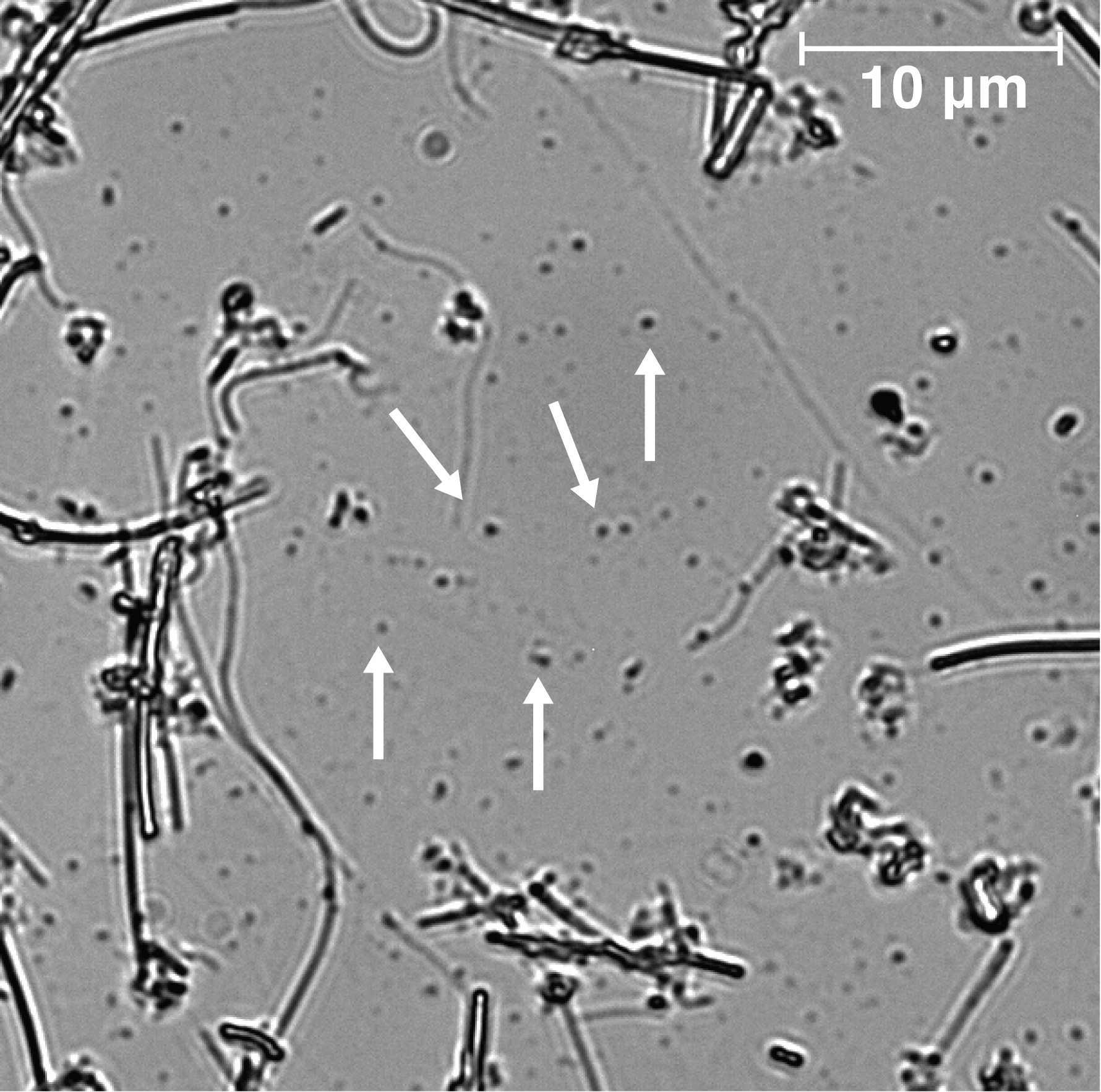 Grayscale micrograph of circular nanoplastics with scattered rods and six white arrows; 10 µm scale.
