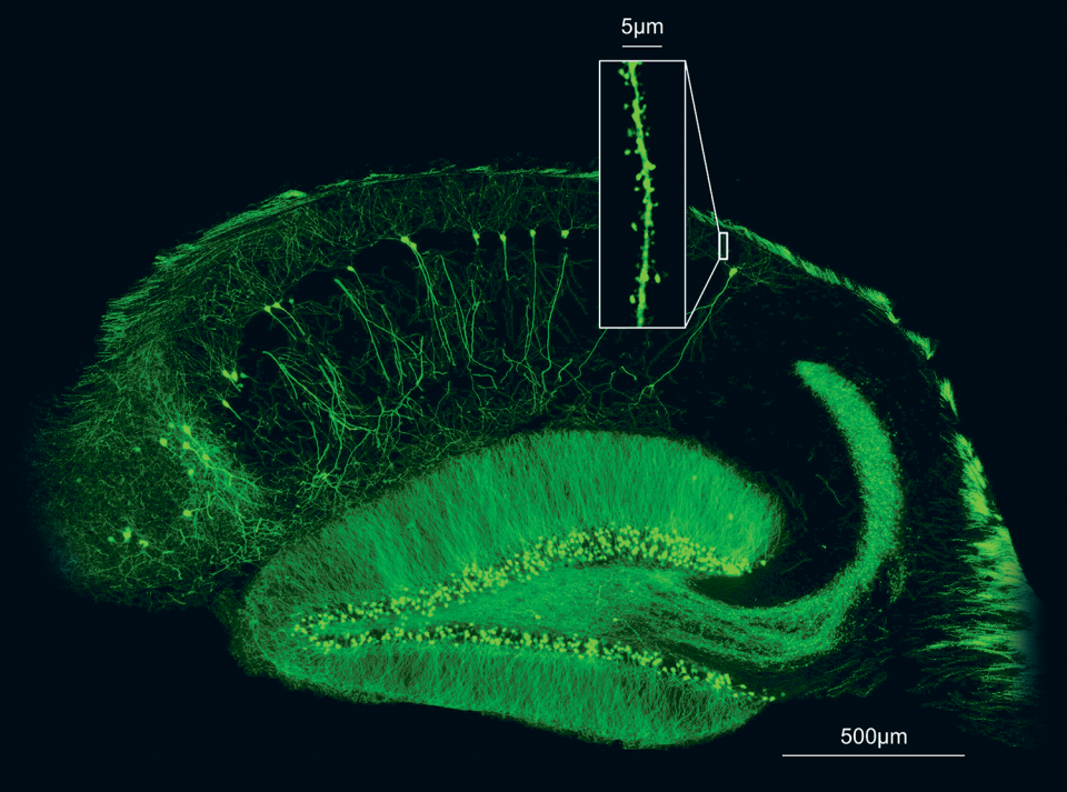 close up of mouse brain