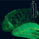 View of a brain scan