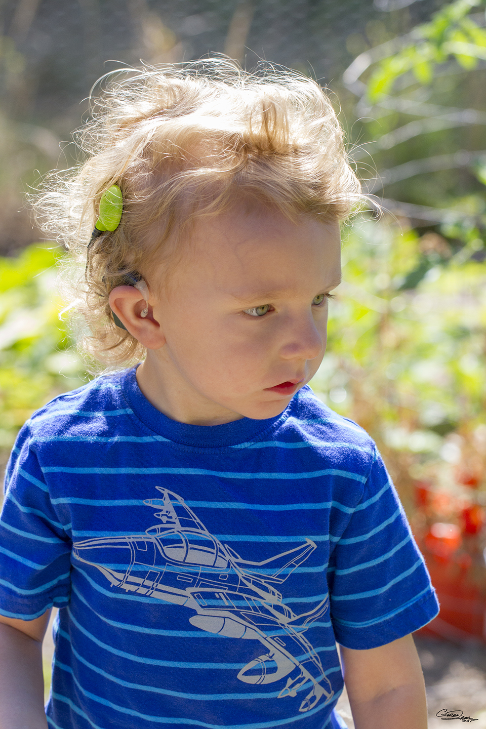 Child with cochlear implant.