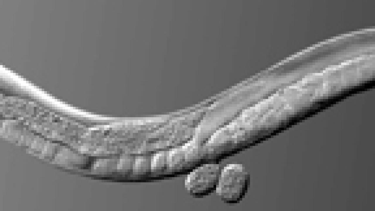 A photomicrograph of C. elegans worm, with the olfactory sensory neuron highlighted.