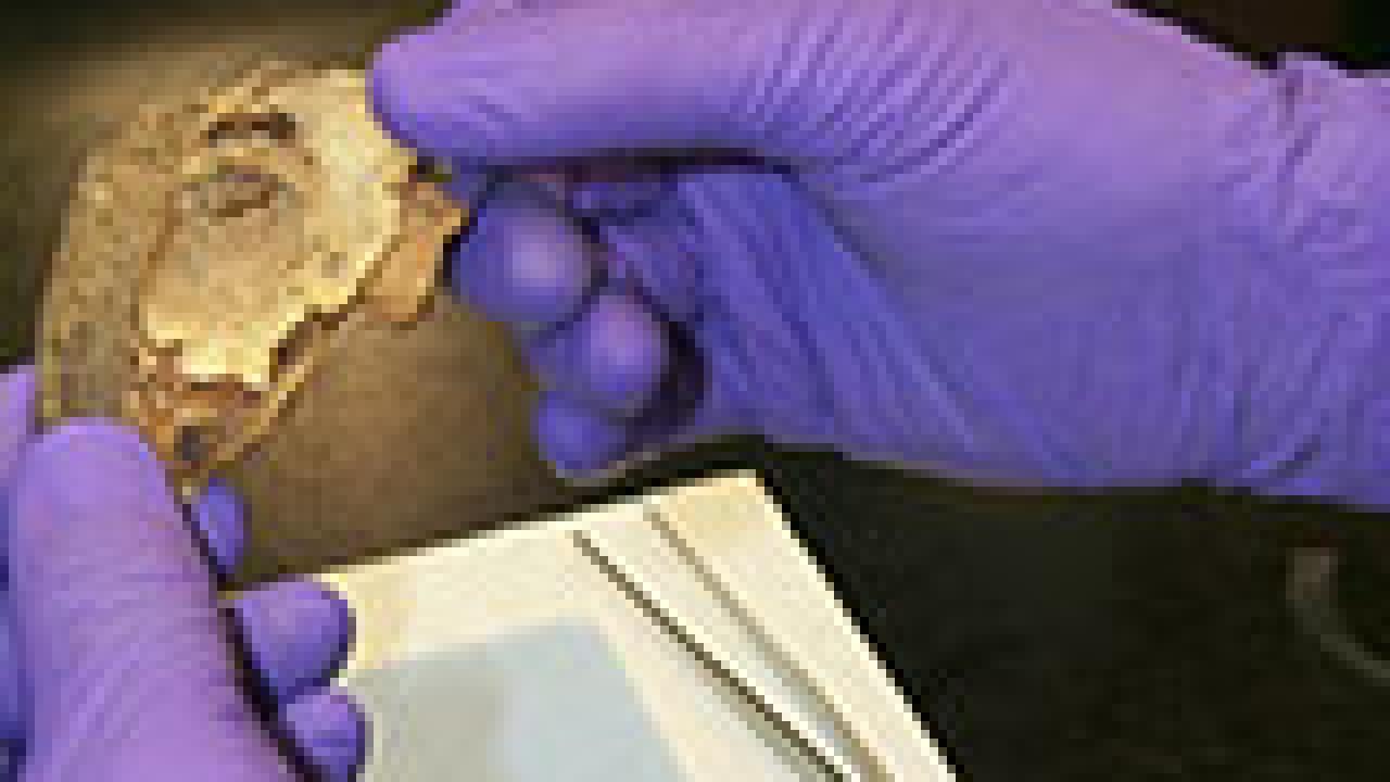 Photo: Mummy eye orbit