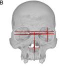 Images of skulls show appproximate locations of the lateral, anterior and inferior cranial measurements used in the analyses.
