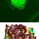 Mast cells caught in the act of starting an allergic reaction. The new confocal/AFM microscope shows both an entire cell (green image), above, and details of the cell surface, below. The images produced by one of the most advanced microscopes of