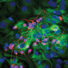 ABSTRACT PAINTING? No, it is a neural stem cell image created from a lab technique.