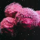 Four red/purple irregular blobs with spiky surfaces against a black background. 